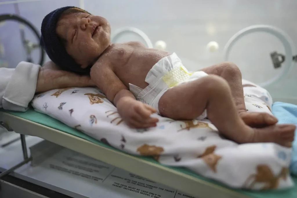 The hyperrealistic Reborn dolls featuring details such as nails, eyelashes, veins, folds and spots on the body have stirred debate in Brazil recently. Photo: AFP